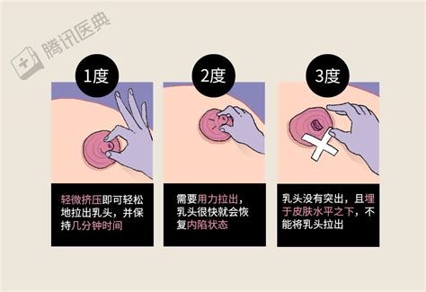 女生乳暈大|乳暈應該多大才算美？原來黃金比例這樣看… 